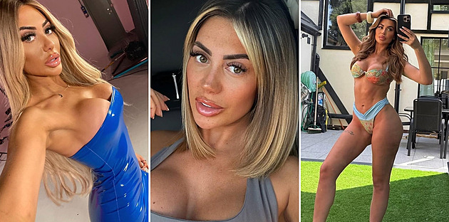 Jak se proměnila Chloe Ferry. Divoška, která miluje plastiky