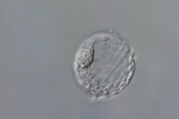 Čeští vědci prozkoumali možnosti genetické úpravy lidských embryí