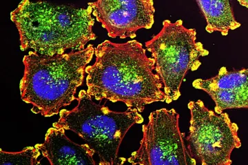 Experimentální vakcína výrazně snižuje riziko návratu melanomu